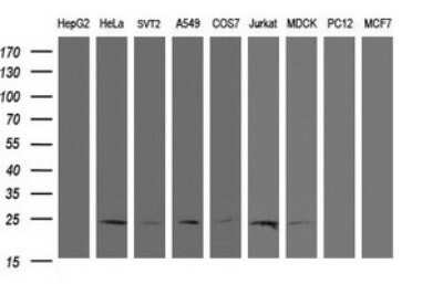 Western Blot: RYBP/DEDAF Antibody (OTI2B4) - Azide and BSA Free [NBP2-73962] - Analysis of extracts (35ug) from 9 different cell lines (HepG2: human; HeLa: human; SVT2: mouse; A549: human; COS7: monkey; Jurkat: human; MDCK: canine; PC12: rat; MCF7: human).