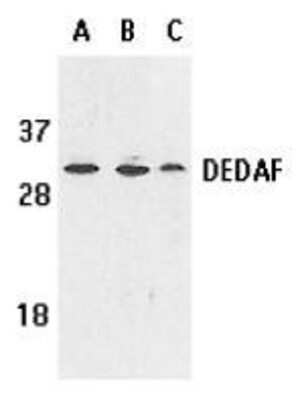 Western Blot: RYBP/DEDAF Antibody [NBP1-76842] - Human A549 (lane A), HepG2 (lane B), and mouse 3T3 (lane C) cell lysates with RYBP/DEDAF antibody at 1 ug /ml.