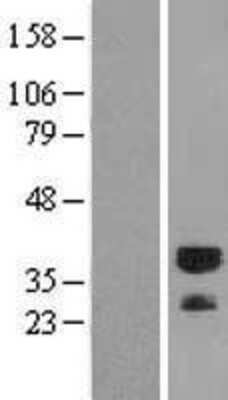 Western Blot: RYBP/DEDAF Overexpression Lysate (Adult Normal) [NBL1-15645] Left-Empty vector transfected control cell lysate (HEK293 cell lysate); Right -Over-expression Lysate for RYBP/DEDAF.