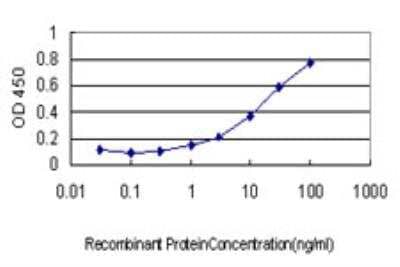 ELISA: Rab17 Antibody (2B7) [H00064284-M05] - Detection limit for recombinant GST tagged RAB17 is approximately 1ng/ml as a capture antibody.