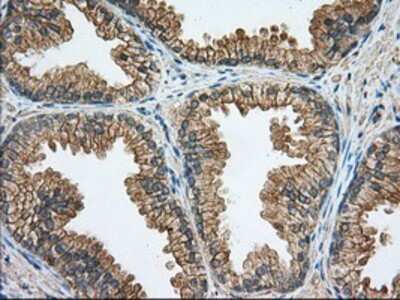 Immunohistochemistry-Paraffin: Rab17 Antibody (5E2) [NBP2-02599] - Staining of paraffin-embedded Human prostate tissue using anti-Rab17 mouse monoclonal antibody.