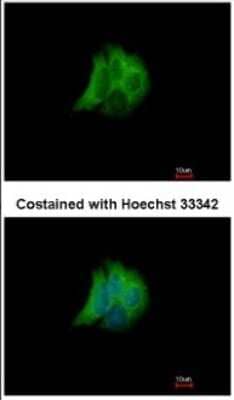 Immunocytochemistry/Immunofluorescence: Rab17 Antibody [NBP2-20036] - Immunofluorescence analysis of methanol-fixed MCF-7, using antibody at 1:200 dilution.