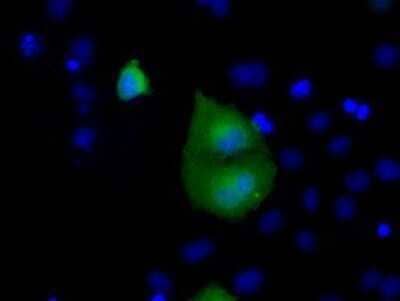 Immunocytochemistry/Immunofluorescence: Rab17 Antibody (OTI5E2) - Azide and BSA Free [NBP2-73765] - Staining of COS7 cells transiently transfected by pCMV6-ENTRY Rab17.