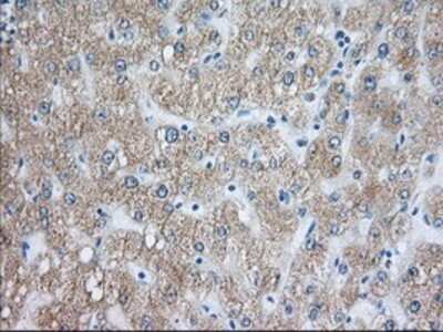 Immunohistochemistry: Rab17 Antibody (OTI5E2) - Azide and BSA Free [NBP2-73765] - Staining of paraffin-embedded Human liver tissue using anti-Rab17 mouse monoclonal antibody.