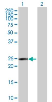 Western Blot: Rab17 Antibody [H00064284-D01P] - Analysis of RAB17 expression in transfected 293T cell line by RAB17 polyclonal antibody.Lane 1: RAB17 transfected lysate(23.50 KDa).Lane 2: Non-transfected lysate.