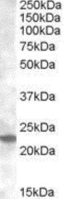 Western Blot: Rab17 Antibody [NBP1-00132] - (0.2ug/ml) staining of Mouse Kidney lysate (35ug protein in RIPA buffer). Primary incubation was 1 hour. Detected by chemiluminescence.