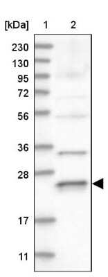 Western Blot: Rab17 Antibody [NBP1-85910] - Lane 1: Marker  [kDa] 230, 130, 95, 72, 56, 36, 28, 17, 11.  Lane 2: Human cell line RT-4.