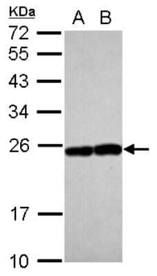 Western Blot Rab17 Antibody