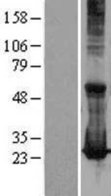 Western Blot Rab17 Overexpression Lysate