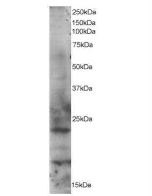 Western Blot: Rab2 Antibody [NB100-775] -  HeLa lysate (RIPA buffer, 35ug total protein per lane). Primary incubated for 1 hour. Detected by western blot using chemiluminescence.