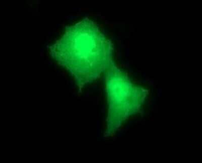 Immunocytochemistry/Immunofluorescence: Rab24 Antibody (OTI3H1) - Azide and BSA Free [NBP2-73770] - Analysis of COS7 cells transiently transfected by pCMV6-ENTRY RAB24.