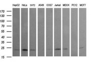 Western Blot: Rab24 Antibody (OTI3H1) - Azide and BSA Free [NBP2-73770] - Analysis of extracts (35ug) from 9 different cell lines (HepG2: human; HeLa: human; SVT2: mouse; A549: human; COS7: monkey; Jurkat: human; MDCK: canine; PC12: rat; MCF7: human).