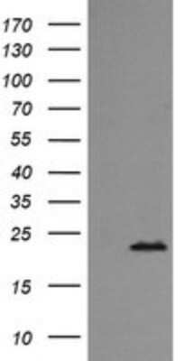 Western Blot: Rab24 Antibody (OTI3H1) - Azide and BSA Free [NBP2-73770] - Analysis of HEK293T cells were transfected with the pCMV6-ENTRY control (Left lane) or pCMV6-ENTRY RAB24.