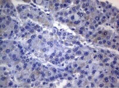 Immunohistochemistry: Rab3A Antibody (OTI1G3) - Azide and BSA Free [NBP2-73773] - Staining of paraffin-embedded Carcinoma of Human liver tissue using anti-RAB3A mouse monoclonal antibody.