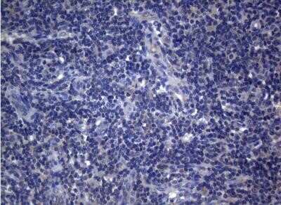 Immunohistochemistry: Rab3A Antibody (OTI1G3) - Azide and BSA Free [NBP2-73773] - Staining of paraffin-embedded Human lymph node tissue within the normal limits using anti-RAB3A mouse monoclonal antibody.