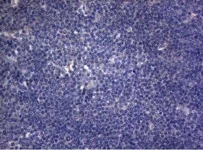 Immunohistochemistry: Rab3A Antibody (OTI1G3) - Azide and BSA Free [NBP2-73773] - Staining of paraffin-embedded Human lymphoma tissue using anti-RAB3A mouse monoclonal antibody.