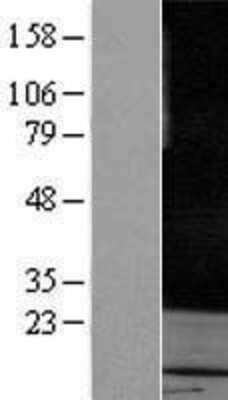 Western Blot: Rab3A Overexpression Lysate (Adult Normal) [NBP2-08067] Left-Empty vector transfected control cell lysate (HEK293 cell lysate); Right -Over-expression Lysate for Rab3A.