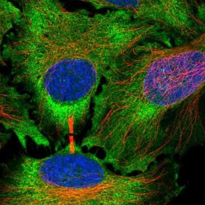 Immunocytochemistry/Immunofluorescence: Rab3C Antibody [NBP2-55288] - Staining of human cell line HeLa shows localization to cytosol.