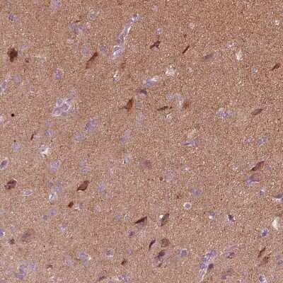 Immunohistochemistry-Paraffin: Rab3C Antibody [NBP2-55288] - Staining of human cerebral cortex shows high expression.