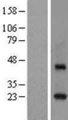 Western Blot Rab3C Overexpression Lysate