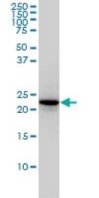 Western Blot: Rab4 Antibody (1C10) [H00005867-M01] - RAB4A monoclonal antibody (M01), clone 1C10 Analysis of RAB4A expression in Hela.