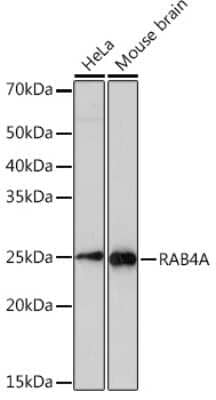 Western Blot: Rab4 Antibody (8I5K1) [NBP3-16307] - Analysis of extracts of various cell lines, using Rab4 Rabbit mAb (NBP3-16307) at 1:1000 dilution. Secondary antibody: HRP Goat Anti-Rabbit IgG (H+L) at 1:10000 dilution. Lysates/proteins: 25ug per lane. Blocking buffer: 3% nonfat dry milk in TBST. Detection: ECL Basic Kit. Exposure time: 3min.