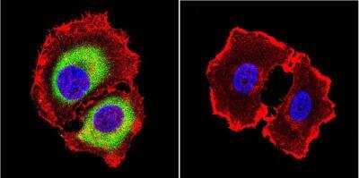 Immunocytochemistry/Immunofluorescence: Rab4 Antibody [NB100-74519] - in MCF-7 Cells. Cells were grown on chamber slides and fixed with formaldehyde prior to staining. Cells were probed without (control) or with a RAB4 polyclonal antibody at a dilution of 1:20 overnight at 4 C, washed with PBS and incubated with a DyLight-488 conjugated secondary antibody and nuclei with DAPI (blue) is shown.