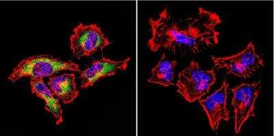 Immunocytochemistry/Immunofluorescence: Rab4 Antibody [NB100-74519] - in HeLa Cells. Cells were grown on chamber slides and fixed with formaldehyde prior to staining. Cells were probed without (control) or with a RAB4 polyclonal antibody at a dilution of 1:100 overnight at 4 C, washed with PBS and incubated with a DyLight-488 conjugated secondary antibody and nuclei with DAPI (blue) is shown.