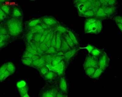 Immunocytochemistry/Immunofluorescence: Rab4 Antibody [NBP3-18233] - Immunocytochemistry/Immunofluorescence analysis using Rabbit Anti-Rab4 Polyclonal Antibody (NBP3-18233). Tissue: HaCaT cells. Species: Human. Fixation: Cold 100% methanol at -20C for 10 minutes. Primary Antibody: Rabbit Anti-Rab4 Polyclonal Antibody (NBP3-18233) at 1:100 for 12 hours at 4C. Secondary Antibody: FITC Goat Anti-Rabbit at 1:50 for 1-2 hours at RT in dark. Localization: String nuclear and cytoplasmic staining.