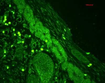 Immunohistochemistry: Rab4 Antibody [NBP3-18233] - Immunohistochemistry analysis using Rabbit Anti-Rab4 Polyclonal Antibody (NBP3-18233). Tissue: backskin. Species: Mouse. Fixation: Bouin's Fixative Solution. Primary Antibody: Rabbit Anti-Rab4 Polyclonal Antibody (NBP3-18233) at 1:100 for 1 hour at RT. Secondary Antibody: FITC Goat Anti-Rabbit (green) at 1:50 for 1 hour at RT. Localization: Epidermis (cell-cell border and cytoplasmic), hair follicles and muscle.