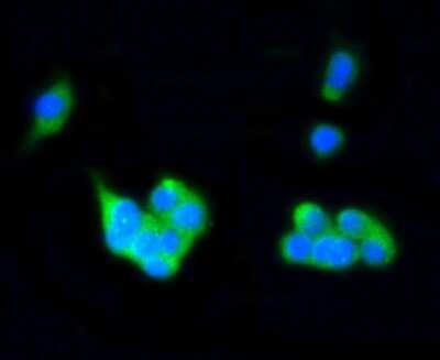 Immunocytochemistry/Immunofluorescence: Rab4 Antibody (SR27-08) [NBP2-67317] - Staining Rab4A in PC-12 cells (green). The nuclear counter stain is DAPI (blue). Cells were fixed in paraformaldehyde, permeabilised with 0.25% Triton X100/PBS.