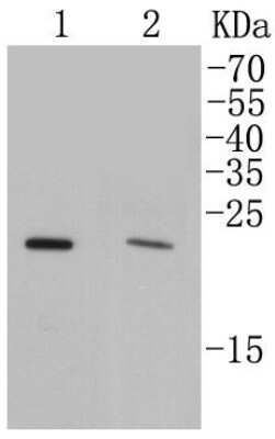 Western Blot: Rab4 Antibody (SR27-08) [NBP2-67317] - Analysis of Rab4A on different cell lysates using anti-Rab4A antibody at 1/500 dilution. Positive control: Lane 1: MCF-7 Lane 2: 293T