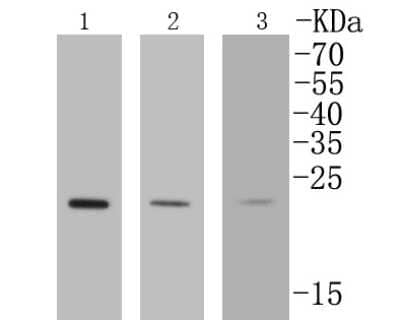 Western Blot: Rab4 Antibody (SR27-08) [NBP2-67317] - Western blot analysis of Rab4 on different lysates. Proteins were transferred to a PVDF membrane and blocked with 5% BSA in PBS for 1 hour at room temperature. The primary antibody (1/500) was used in 5% BSA at room temperature for 2 hours. Goat Anti-Rabb