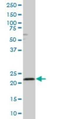 Western Blot: Rab4 Antibody [H00005867-B01P] - Analysis of RAB4A expression in rat brain.