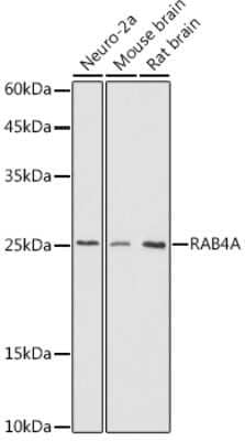 Western Blot: Rab4 Antibody [NBP3-16640] - Western blot analysis of extracts of various cell lines, using Rab4 antibody (NBP3-16640) at 1:500 dilution. Secondary antibody: HRP Goat Anti-Rabbit IgG (H+L) at 1:10000 dilution. Lysates/proteins: 25ug per lane. Blocking buffer: 3% nonfat dry milk in TBST. Detection: ECL Basic Kit. Exposure time: 180s.