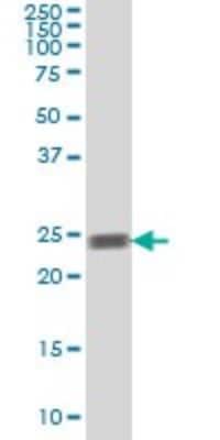 Western Blot: Rab5a Antibody (5D1) [H00005868-M09A] - Analysis of RAB5A expression in K-562 (Cat # L009V1).