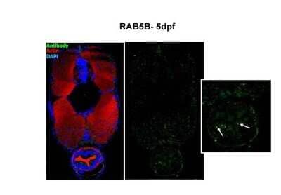 Immunohistochemistry-Paraffin: Rab5b Antibody [NBP1-58938] - Sample type: zebra gut epithelial cells, Green: primary, Red: actin, Blue : DAPI, Primary dilution : 1:5000 , Secondary Dilution : 1:300, Image Submitted by: Michel Bagnat, Duke University Medical Center See Customer Feedback tab for detailed information.