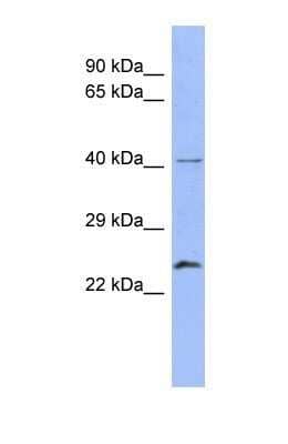 Western Blot: Rab5b Antibody [NBP1-58938] - Human placenta tissue lysate at a concentration of 1ug/ml.