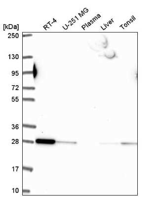 Western Blot Rab5b Antibody - BSA Free