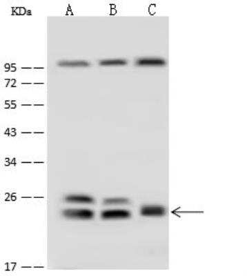 Western Blot: Rab5b Antibody [NBP2-99625] - Lane A: HeLa Whole Cell LysateLane B: Jurkat Whole Cell LysateLane C: HEK293 Whole Cell LysateLysates/proteins at 30 ug per lane.SecondaryGoat Anti-Rabbit IgG (H+L)/HRP at 1/10000 dilution.Developed using the ECL technique.Performed under reducing conditions.Predicted band size:23 kDaObserved band size:23 kDa