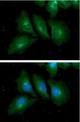 Immunocytochemistry/Immunofluorescence: Rab7a Antibody (10E4) [NBP2-60237] - Staining in HeLa cells. The secondary antibody (green) was Alexa Fluor 488. DAPI was stained the cell nucleus (blue).