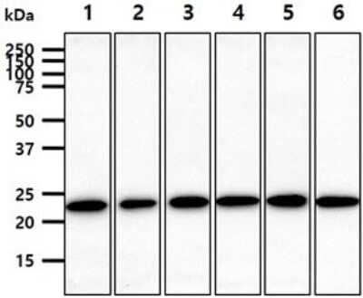 Western Blot: Rab7a Antibody (10E4) [NBP2-60237] - The cell lysates (40ug) were resolved by SDS-PAGE, transferred to PVDF membrane and probed with anti-human Rab7A antibody (1:1000). Proteins were visualized using a goat anti-mouse secondary antibody conjugated to HRP and an ECL detection system.Lane 1.: HeLa cell lysateLane 2.: Jurkat cell lysate Lane 3.: MCF7 cell lysate Lane 4.: PC3 cell lysateLane 5.: 293T cell lysateLane 6.: SK-OV-3 cell lysate