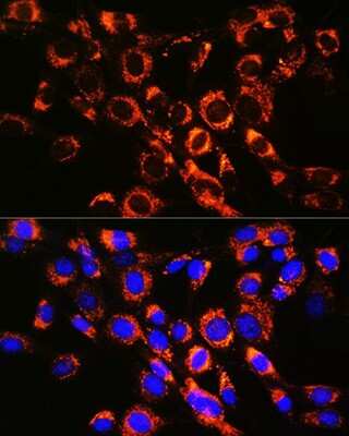 Immunocytochemistry/Immunofluorescence: Rab7a Antibody (4X3P6) [NBP3-15444] - Immunofluorescence analysis of NIH-3T3 cells using Rab7a Rabbit mAb (NBP3-15444) at dilution of 1:100 (40x lens). Blue: DAPI for nuclear staining.