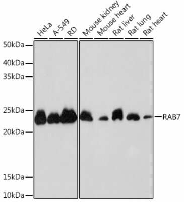 Western Blot: Rab7a Antibody (4X3P6) [NBP3-15444] - Western blot analysis of extracts of various cell lines, using Rab7a Rabbit mAb (NBP3-15444) at 1:1000 dilution. Secondary antibody: HRP Goat Anti-Rabbit IgG (H+L) at 1:10000 dilution. Lysates/proteins: 25ug per lane. Blocking buffer: 3% nonfat dry milk in TBST. Detection: ECL Basic Kit. Exposure time: 10s.