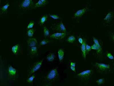 Immunocytochemistry/Immunofluorescence: Rab7a Antibody [NBP2-97183] - Immunofluorescence staining of Rab7a in U251MG cells. Cells were fixed with 4% PFA, permeabilzed with 0.1% Triton X-100 in PBS, blocked with 10% serum, and incubated with rabbit anti-Human Rab7a polyclonal antibody (dilution ratio 1:100) at 4C overnight. Then cells were stained with the Alexa Fluor(R)488-conjugated Goat Anti-rabbit IgG secondary antibody (green) and counterstained with DAPI (blue).Positive staining was localized to Cytoplasm.