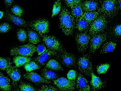 Immunocytochemistry/Immunofluorescence: Rab7a Antibody [NBP2-98732] - Immunofluorescence staining of Rab7a in A431 cells. Cells were fixed with 4% PFA, permeabilzed with 0.3% Triton X-100 in PBS, blocked with 10% serum, and incubated with rabbit anti-human Rab7a polyclonal antibody (1:5000) at 4C overnight. Then cells were stained with the Alexa Fluor(R)488-conjugated Goat Anti-rabbit IgG Secondary antibody (green) and counterstained with DAPI (blue). Positive staining was localized to cytoplasm.