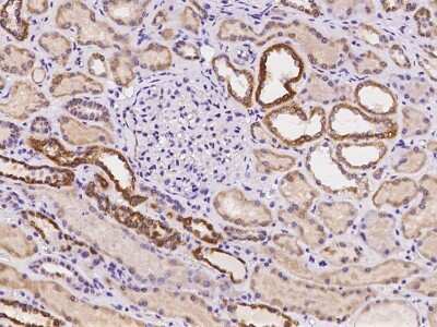 Immunohistochemistry-Paraffin: Rab7a Antibody [NBP2-97183] - Immunochemical staining of human Rab7a in human kidney with rabbit polyclonal antibody at 1:100 dilution, formalin-fixed paraffin embedded sections.