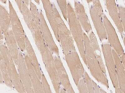 Immunohistochemistry-Paraffin: Rab7a Antibody [NBP2-97183] - Immunochemical staining of human Rab7a in human skeletal muscle with rabbit polyclonal antibody at 1:100 dilution, formalin-fixed paraffin embedded sections.