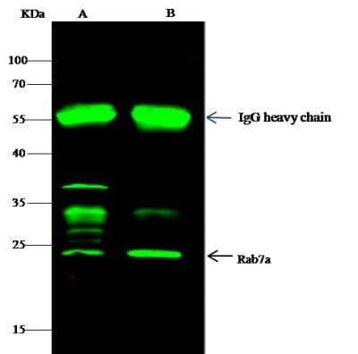 Immunoprecipitation: Rab7a Antibody [NBP2-98446] - Lane A:0.5 mg A431 Whole Cell LysateLane B:0.5 mg K562 Whole Cell Lysate2 uL anti-rat Rab7a rabbit polyclonal antibody and 60 ug of Immunomagnetic beads Protein G.Primary antibody:Anti-rat Rab7a rabbit polyclonal antibody,at 1:100 dilution Secondary antibody:Dylight 800-labeled antibody to rabbit IgG (H+L), at 1:5000 dilution Developed using the odssey technique.Performed under reducing conditions.Predicted band size: 23 kDaObserved band size: 23 kDa