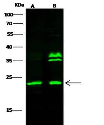 Western Blot: Rab7a Antibody [NBP2-98446] - Lane A: A431 Whole Cell LysateLane B: K562 Whole Cell LysateLysates/proteins at 30 ug per lane.SecondaryGoat Anti- Rabbit  IgG H&L (Dylight 800)  at 1/10000 dilution.Developed using the Odyssey technique. Performed under reducing conditions.Predicted band size:23 kDaObserved band size:23 kDa(We are unsure as to the identity of these extra bands.)